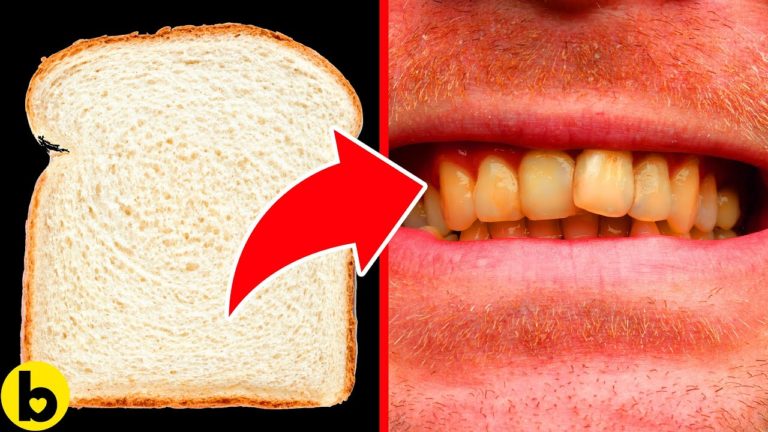 11 Foods To Avoid If You Want Beautiful, White Teeth