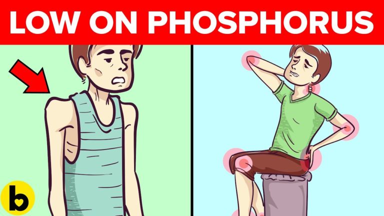 7 Signs You Have A Phosphorus Deficiency