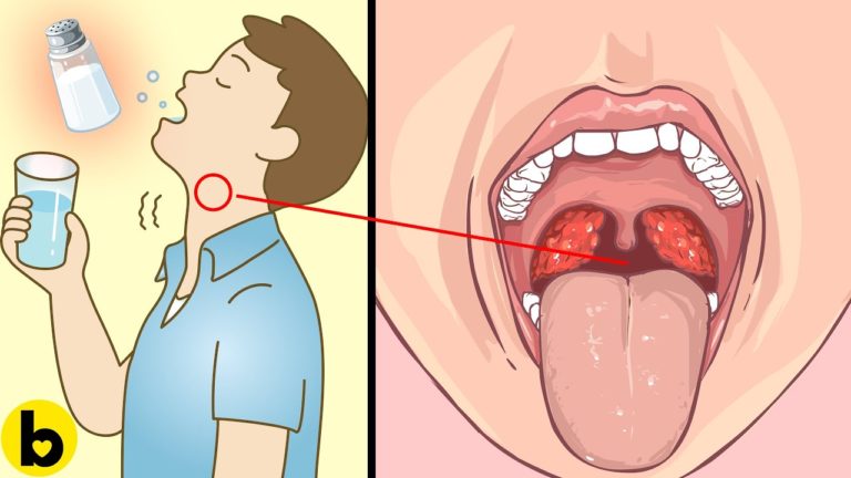 Gargle Salt Water For 1 Week, See What Happens To Your Body