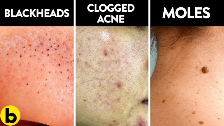 8 Serious Diseases That Are Signaled By Our Skin