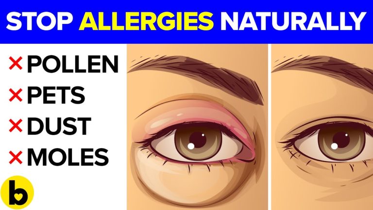 14 Natural Ways to Defeat Allergies