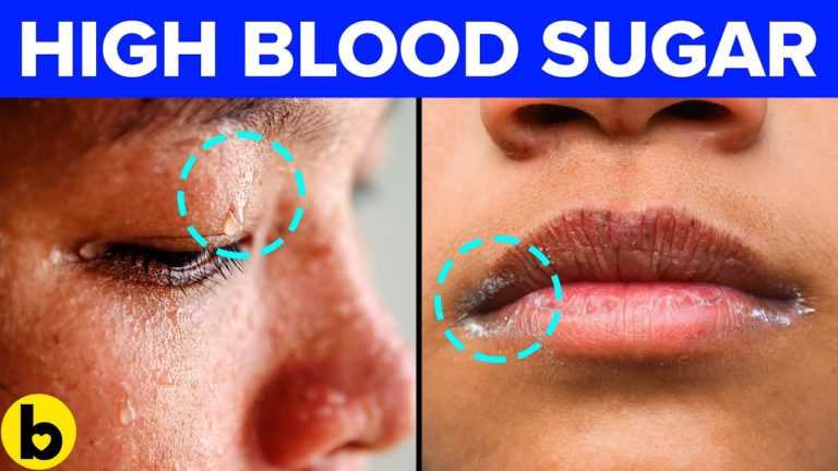 Your Blood Sugar IS HIGH! – 9 Warning Signs To Look Out For