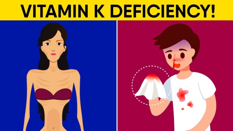 12 Hidden Signs You Have Vitamin K Deficiency