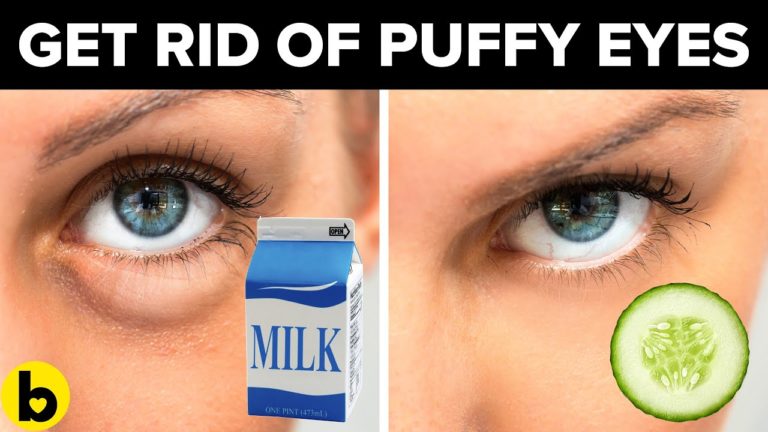 Have Puffy Eyes? These Foods May be Responsible