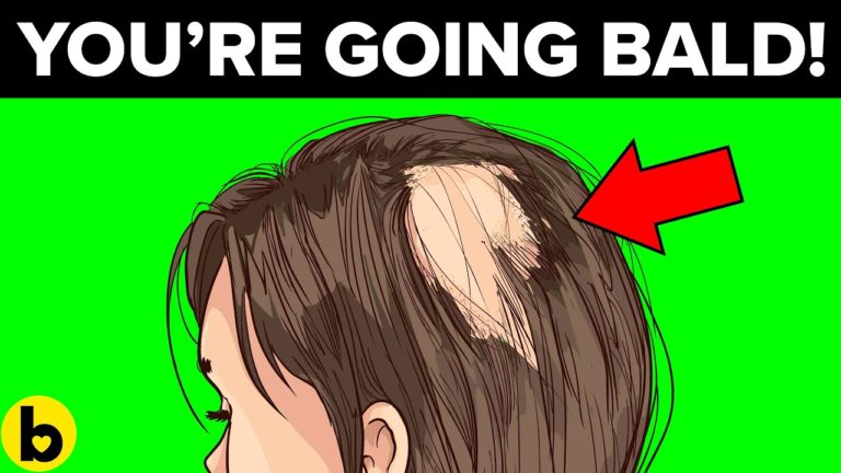 7 Reasons You’re Going Bald