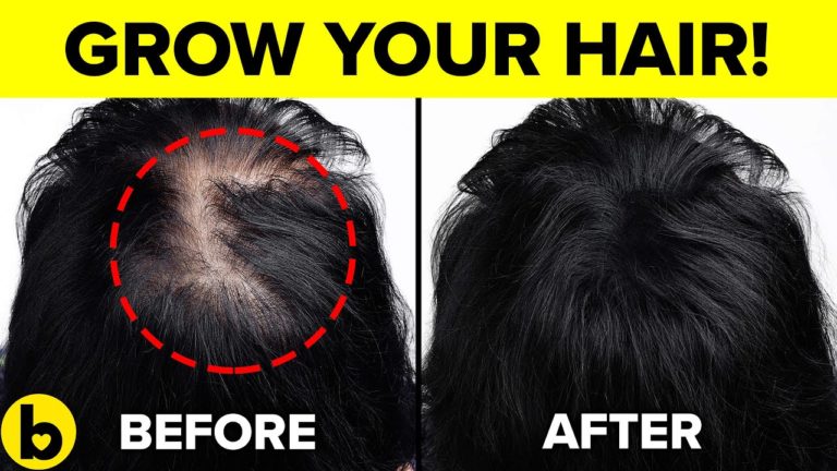 Grow Your Hair With This One Magic Solution