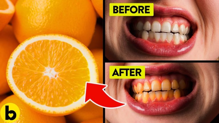 11 Foods You Didn’t Know Are Harming Your Teeth