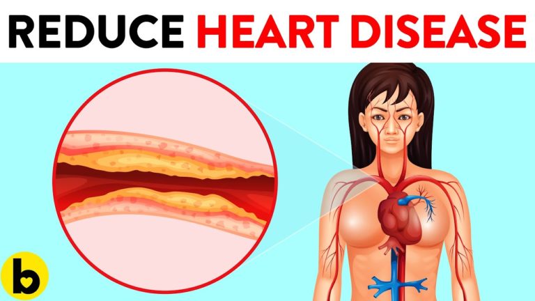 15 Best Ways To Drastically Reduce Your Risk of Heart Disease