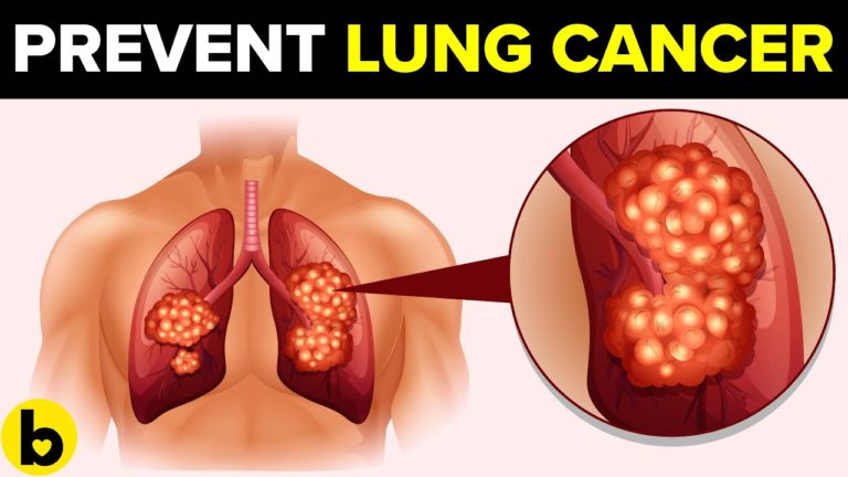 How To Reduce Your Chances Of Getting Lung Cancer