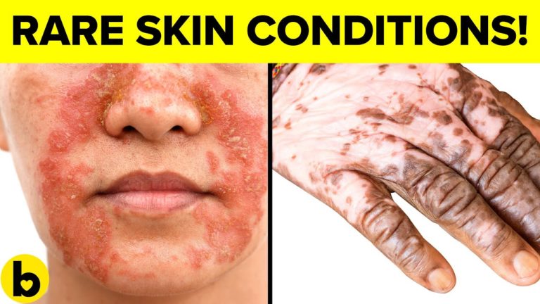 9 DESTRUCTIVE Skin DISEASES And Why You WILL Get Them