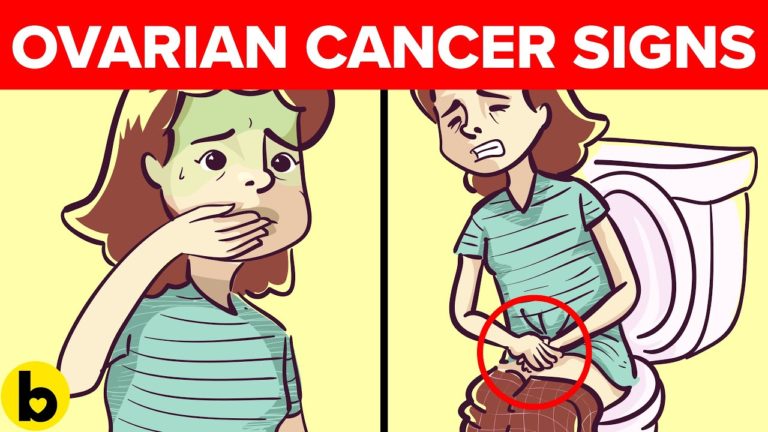 8 Signs Of Ovarian Cancer You Shouldn’t Ignore