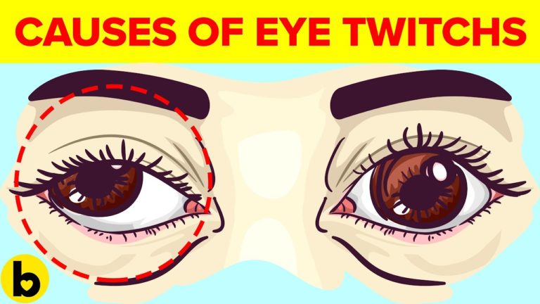 9 Causes Behind Your Eye Twitch