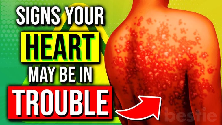 Don’t Ignore The 4 WARNING Signs Your HEART May Be In TROUBLE!