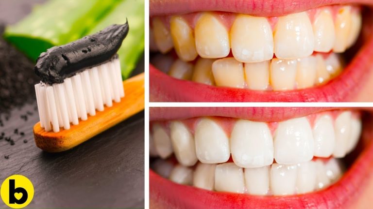 Whiten Your Teeth In Just Minutes With These 8 Home Remedies