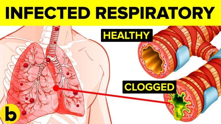 6 Ways You’ll Get A Respiratory Infection