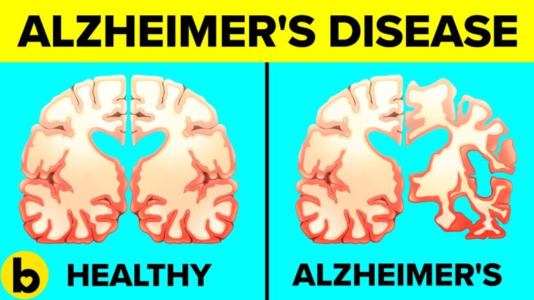 9 Daily Habits That Are Linked To Alzheimer’s Disease