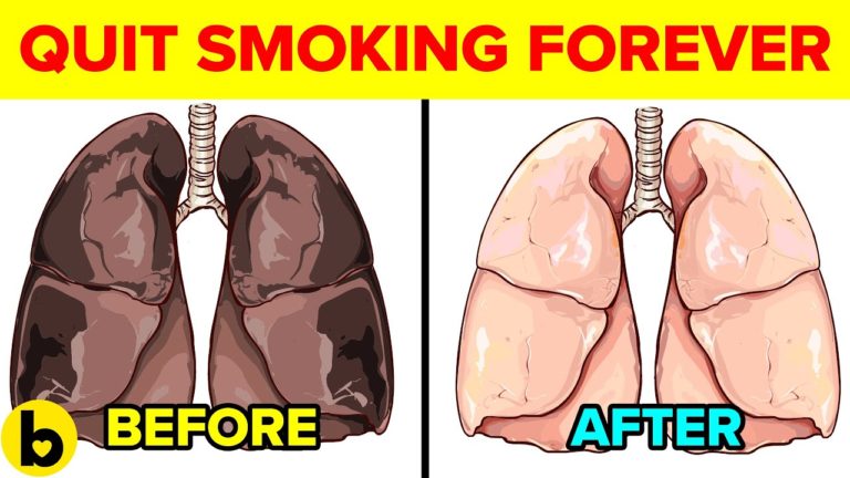 8 Easy Ways To Finally Quit Smoking Forever