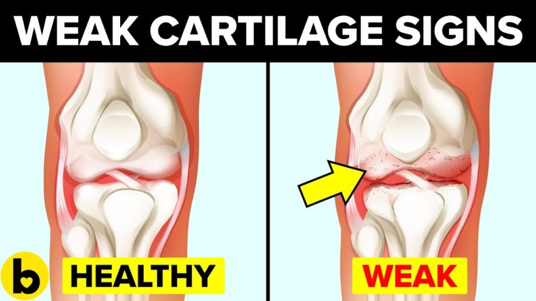 7 Signs Of Weak Cartilage That Should NEVER Be Ignored