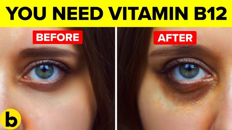 How Vitamin B12 Deficiency Is Hurting Your Health Without You Knowing