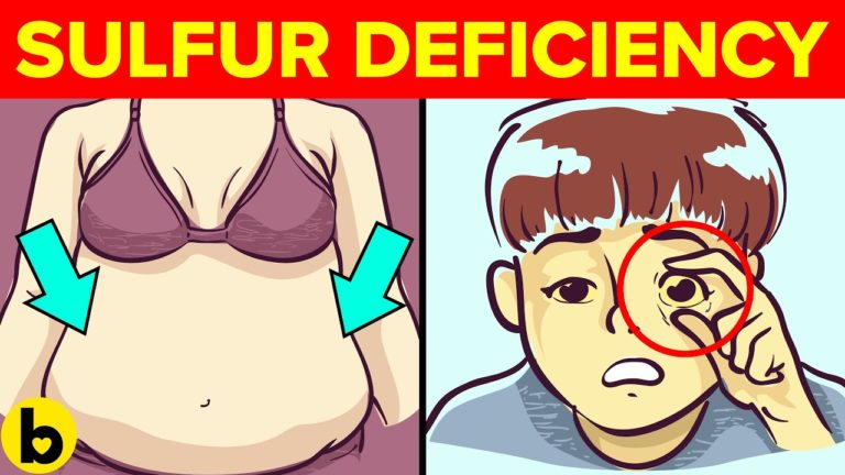 7 Signs You Have Sulfur Deficiency