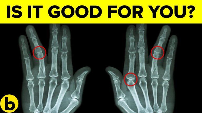 Is Cracking Your Knuckles Good For You?