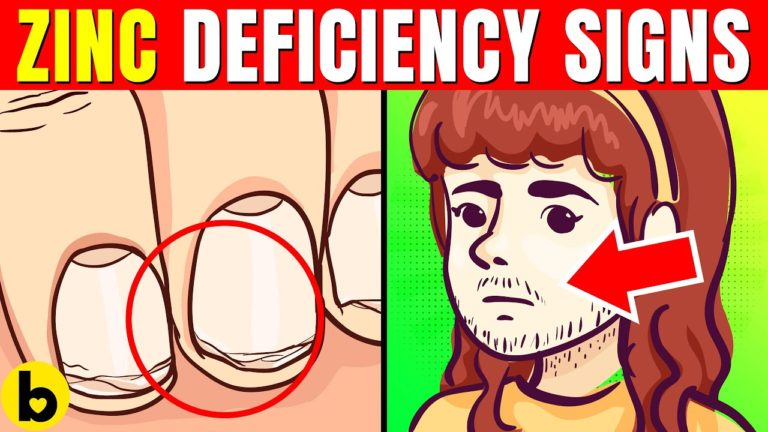 16 ALARMING Signs & Symptoms Of Zinc Deficiency